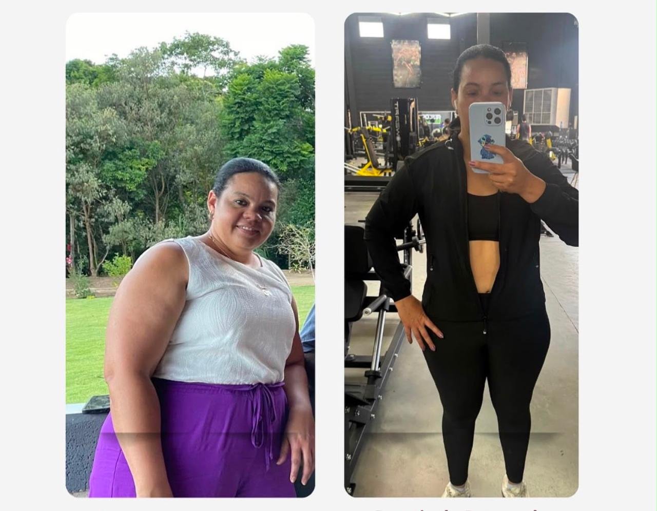 Evolução de paciente — antes e depois