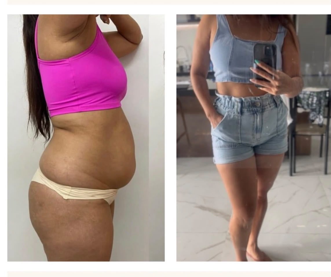 Evolução de paciente — antes e depois